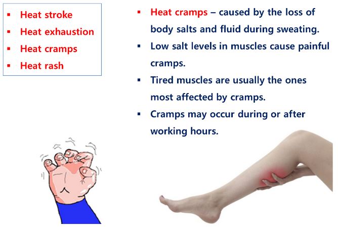 heat cramps