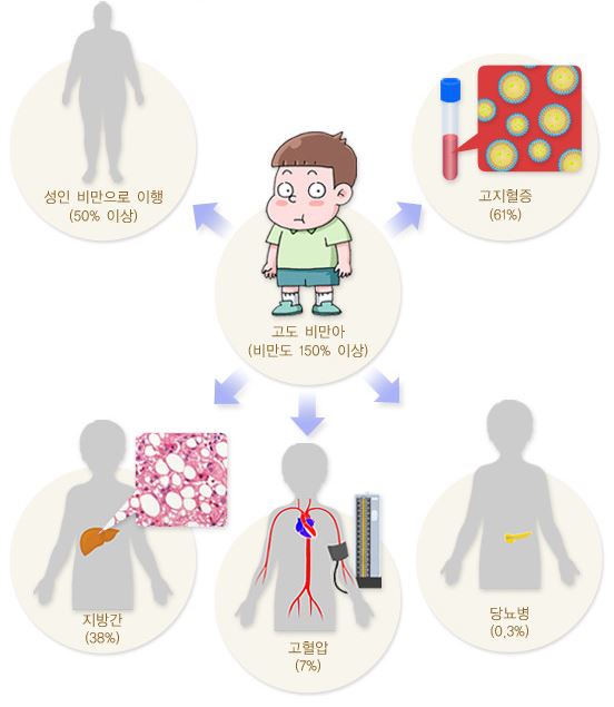 고도비만